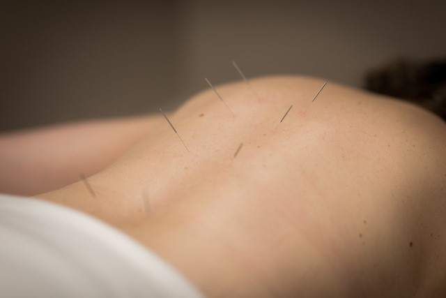 Mankato Acupuncture